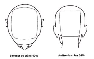 evaluation surface pelade