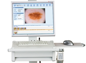 Dermatoscope